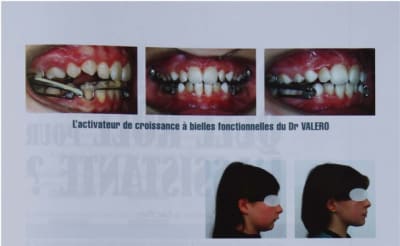 Img 2869 1 g74qye - Eugenol