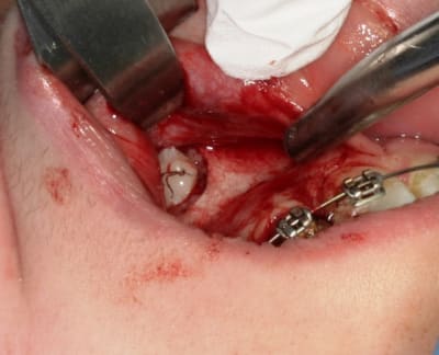 Img 2929 cjguhi - Eugenol