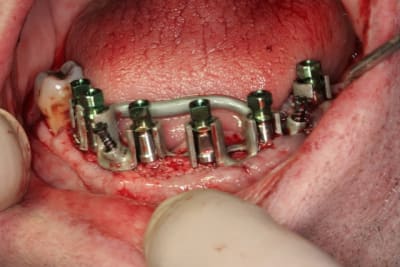Img 2994 evck0e - Eugenol