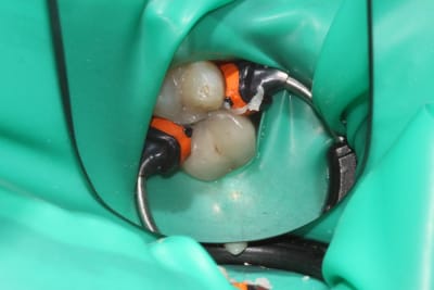 Img 3004 pgwprk - Eugenol