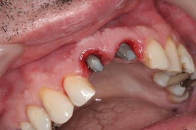 Img 3018 rccxu5 - Eugenol