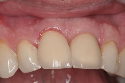 Img 3109 susrjd - Eugenol