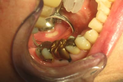 Img 3113 ys8bou - Eugenol