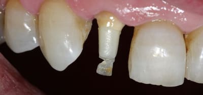 Img 3165 zugndi - Eugenol