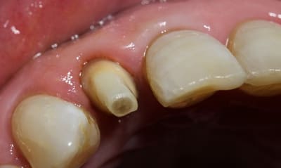 Img 3181 seecf0 - Eugenol