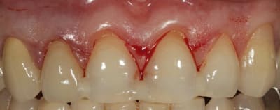 Img 3207 zv1iut - Eugenol