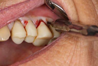 Img 3351 ojrp3i - Eugenol