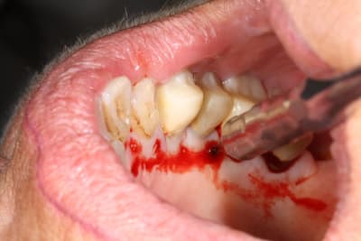 Img 3357 ykskfa - Eugenol