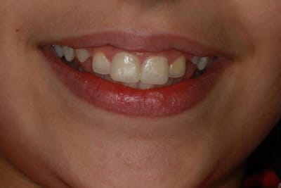 Img 3448 p2ye5c - Eugenol