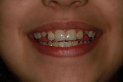 Img 3539 pybfw1 - Eugenol