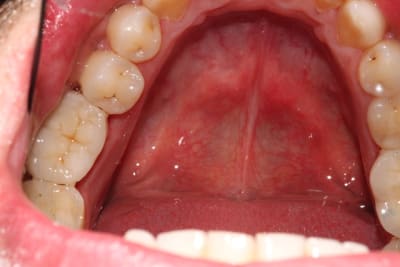 Img 3547 v4hue0 - Eugenol