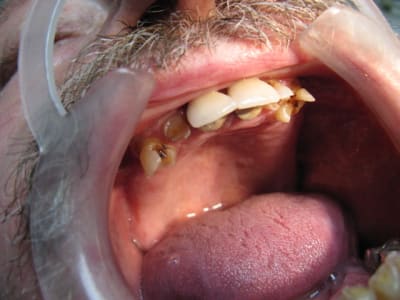 Img 3610 l13num - Eugenol