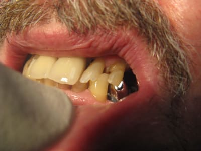 Img 3616 kf9obs - Eugenol