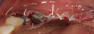 Img 3624 mqjmoh - Eugenol