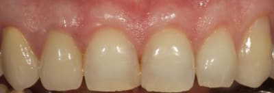 Img 3772 lofj9d - Eugenol