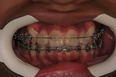 Img 3 9221 ghe6th - Eugenol