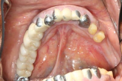 Img 4243 pxprou - Eugenol