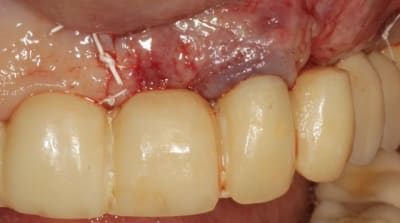 Img 4247 ulwrm7 - Eugenol