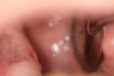 Img 4725 hv1rac - Eugenol