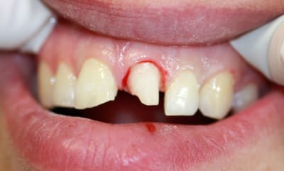 Img 4797 pzlg4v - Eugenol