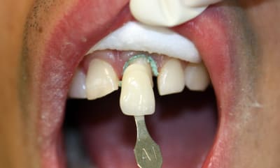 Img 4802 giujis - Eugenol