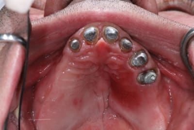 Img 4912 ixxgjk - Eugenol