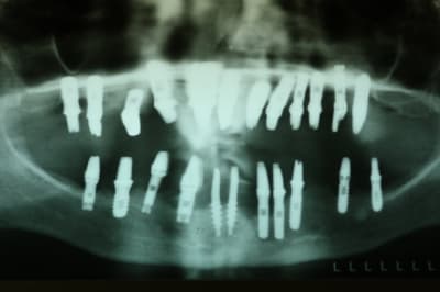 Img 5169 g5sqqd - Eugenol