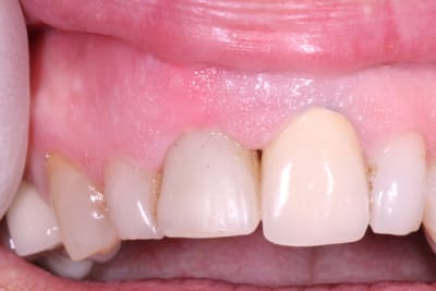 Img 5189 rwsqc1 - Eugenol