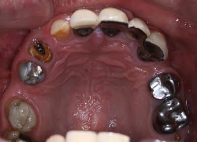 Img 5233 yjzo1u - Eugenol