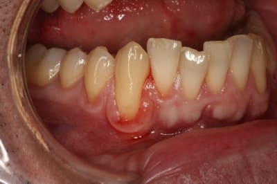 Img 5605  desktop resolution  a0ooq3 - Eugenol