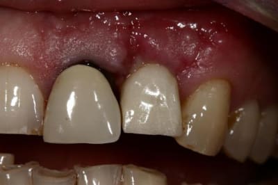 Img 5758  large  hf15yr - Eugenol