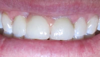 Img 5815 gymgib - Eugenol