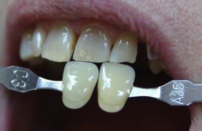 Img 5830 sx42wd - Eugenol