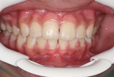 Img 5 z8ak0k - Eugenol