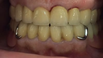 Img 6171 ayklqk - Eugenol