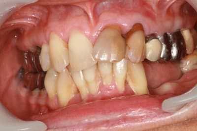 Img 6184 ykqsom - Eugenol