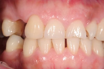 Img 6200 dry5ec - Eugenol