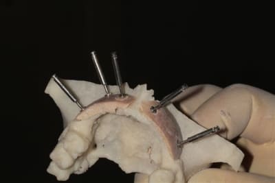 Img 6298 re2xct - Eugenol