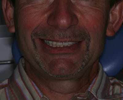 Img 63711 bneaap - Eugenol