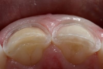 Img 6424  1024x768  zv9t5e - Eugenol