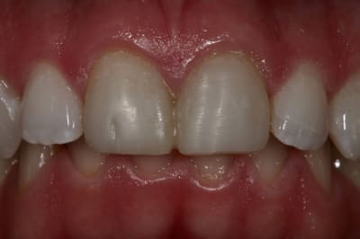 Img 6439 vakcre - Eugenol