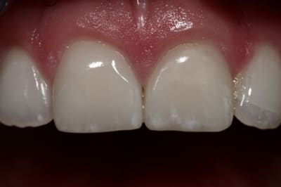 Img 6474  1024x768  vi342n - Eugenol