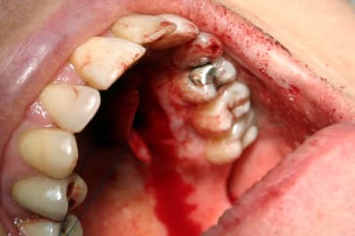 Img 6687 hp1onq - Eugenol