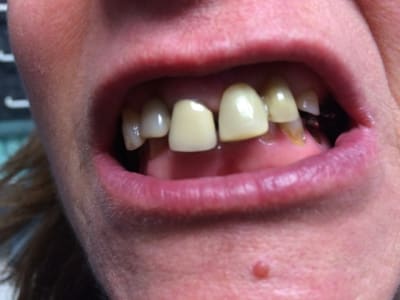 Img 6776 lf80pf - Eugenol