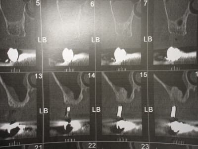 Img 6813 hytq7g - Eugenol