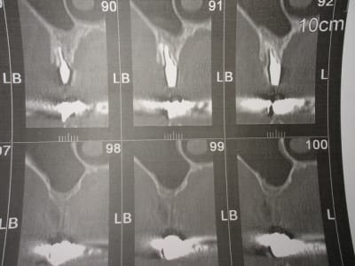 Img 6824 m5p2og - Eugenol