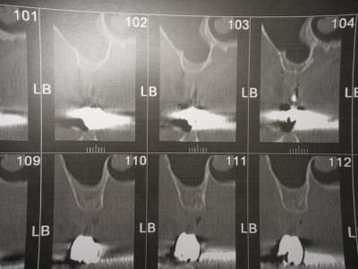 Img 6825 alynh7 - Eugenol