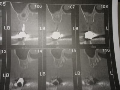 Img 6826 glvkka - Eugenol