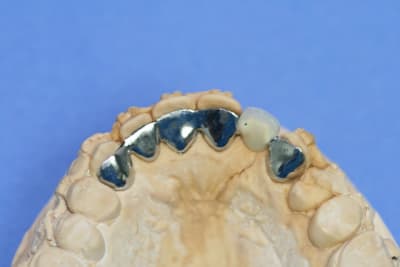 Img 6839 vrhy7b - Eugenol