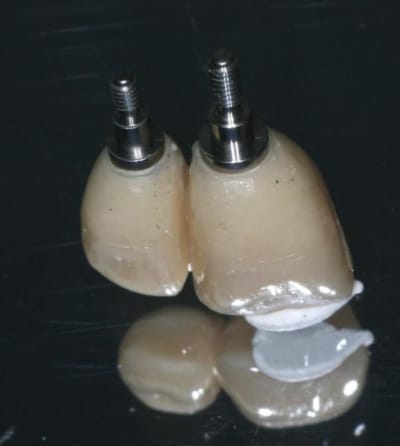 Img 6959 aigjni - Eugenol